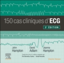 Image for 150 cas cliniques d&#39;ECG