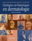 Image for Quelques cas historiques en dermatologie