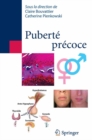 Image for Puberte precoce