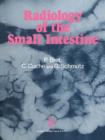 Image for Radiology of the small intestine