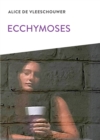 Image for Ecchymoses