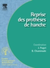 Image for Reprise Des Protheses De Hanches