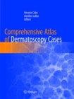 Image for Comprehensive Atlas of Dermatoscopy Cases
