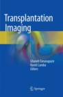 Image for Transplantation Imaging