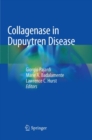 Image for Collagenase in Dupuytren Disease