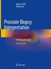 Image for Prostate Biopsy Interpretation