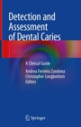 Image for Detection and assessment of dental caries: a clinical guide