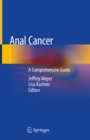 Image for Anal cancer: a comprehensive guide