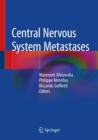 Image for Central Nervous System Metastases