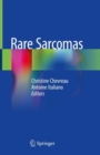 Image for Rare Sarcomas