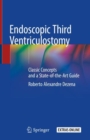 Image for Endoscopic Third Ventriculostomy : Classic Concepts and a State-of-the-Art Guide