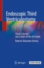 Image for Endoscopic Third Ventriculostomy : Classic Concepts and a State-of-the-Art Guide