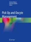 Image for Pick Up and Oocyte Management