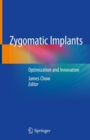Image for Zygomatic Implants : Optimization and Innovation