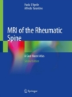Image for MRI of the Rheumatic Spine