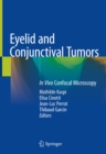 Image for Eyelid and Conjunctival Tumors: In Vivo Confocal Microscopy