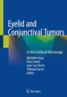 Image for Eyelid and Conjunctival Tumors : In Vivo Confocal Microscopy