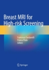 Image for Breast MRI for High-risk Screening