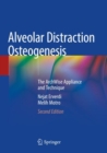 Image for Alveolar Distraction Osteogenesis
