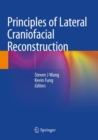 Image for Principles of Lateral Craniofacial Reconstruction