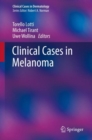 Image for Clinical Cases in Melanoma