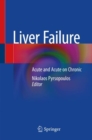 Image for Liver failure  : acute and acute on chronic