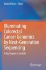 Image for Illuminating Colorectal Cancer Genomics by Next-Generation Sequencing