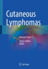 Image for Cutaneous lymphomas  : unusual cases3