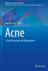 Image for Acne  : current concepts and management