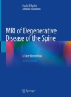 Image for MRI of Degenerative Disease of the Spine