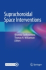 Image for Suprachoroidal Space Interventions