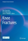Image for Knee Fractures