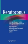 Image for Keratoconus