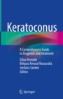 Image for Keratoconus: A Comprehensive Guide to Diagnosis and Treatment