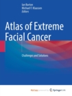 Image for Atlas of Extreme Facial Cancer : Challenges and Solutions