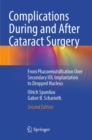 Image for Complications during and after cataract surgery  : from phacoemulsification over secondary IOL implantation to dropped nucleus