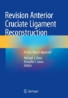 Image for Revision anterior cruciate ligament reconstruction  : a case-based approach