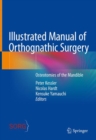 Image for Illustrated Manual of Orthognathic Surgery