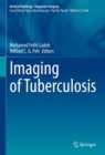 Image for Imaging of tuberculosis