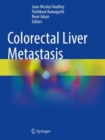 Image for Colorectal Liver Metastasis