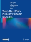 Image for Video-Atlas of VATS Pulmonary Sublobar Resections