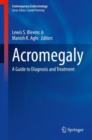 Image for Acromegaly: A Guide to Diagnosis and Treatment