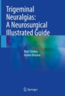 Image for Trigeminal neuralgias  : a neurosurgical illustrated guide