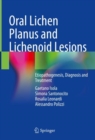 Image for Oral Lichen Planus and Lichenoid Lesions