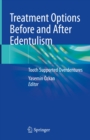Image for Treatment Options Before and After Edentulism: Tooth Supported Overdentures