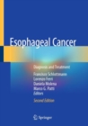 Image for Esophageal Cancer