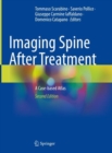 Image for Imaging Spine After Treatment
