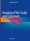 Image for Imaging of the scalp and calvarium