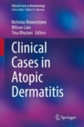 Image for Clinical Cases in Atopic Dermatitis