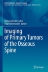 Image for Imaging of Primary Tumors of the Osseous Spine
